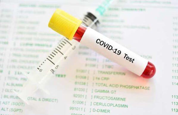 В Перми тест на коронавирус начали делать частные клиники