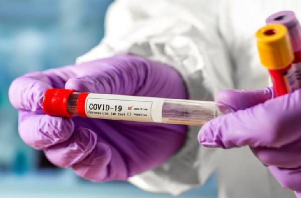 Частные клиники Перми рассказали о спросе на коронавирусный анализ 